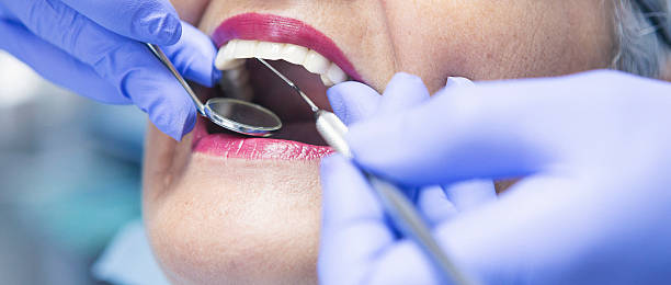 Best Emergency Tooth Extraction in Minneola, FL